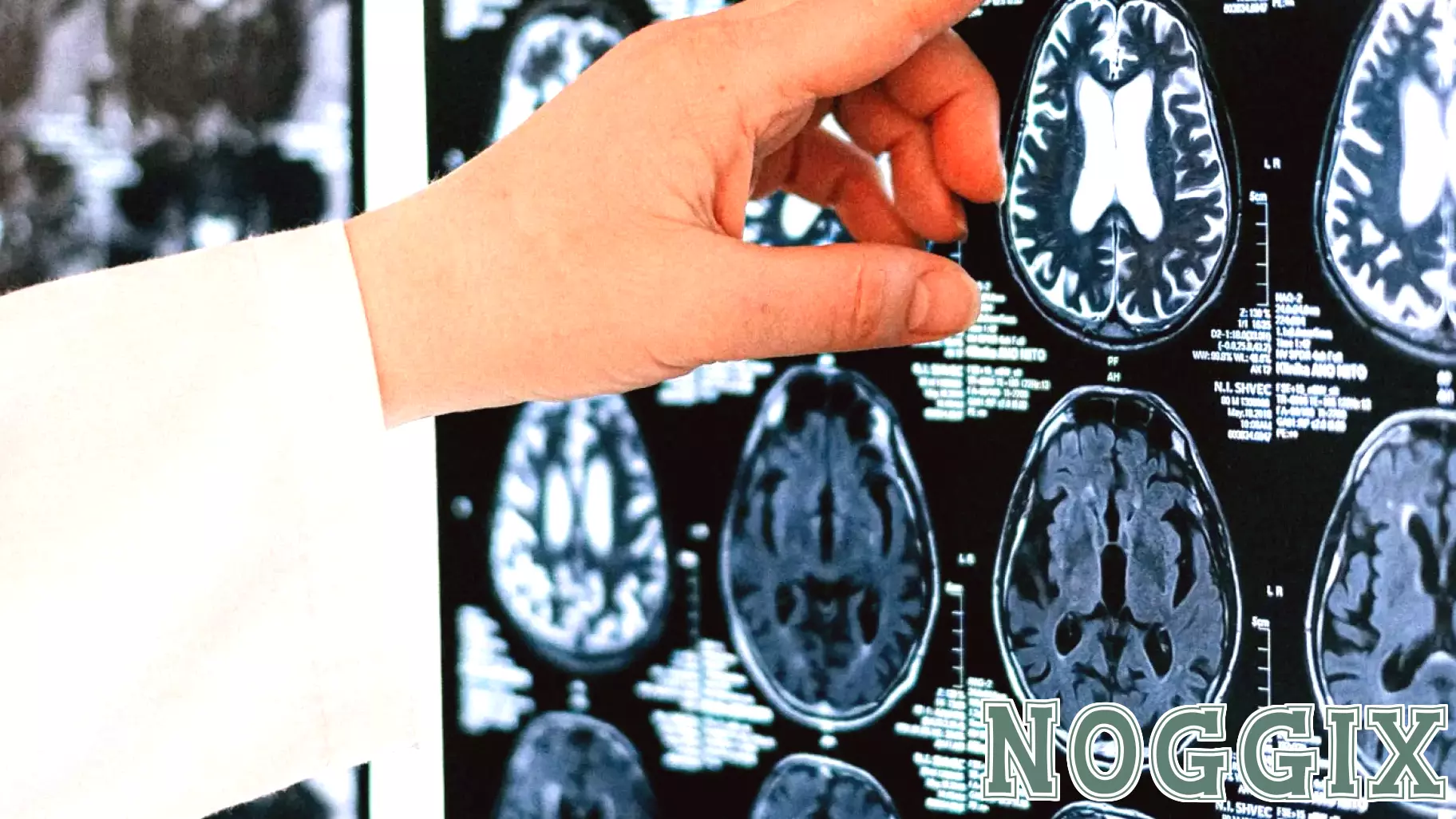 How Trauma Hijacks Your Brain (and How EMDR Can Help)