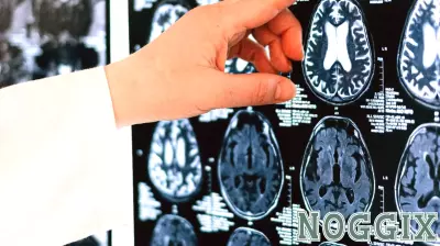 How Trauma Hijacks Your Brain (and How EMDR Can Help)